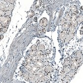 Anti-MAT2A antibody produced in rabbit Prestige Antibodies&#174; Powered by Atlas Antibodies, affinity isolated antibody, buffered aqueous glycerol solution