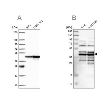 Anti-SLBP antibody produced in rabbit Prestige Antibodies&#174; Powered by Atlas Antibodies, affinity isolated antibody