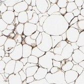 Anti-PRKAR2B antibody produced in rabbit Prestige Antibodies&#174; Powered by Atlas Antibodies, affinity isolated antibody, buffered aqueous glycerol solution