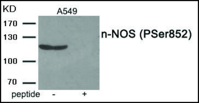 Anti-phospho-n-NOS (pSer852) antibody produced in rabbit affinity isolated antibody