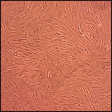 Human Fibroblast-Like Synoviocytes-Osteoarthritis: HFLS-OA, adult