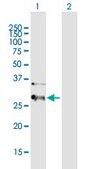 Anti-HIBADH antibody produced in mouse IgG fraction of antiserum, buffered aqueous solution