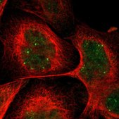 Anti-CRCP antibody produced in rabbit Prestige Antibodies&#174; Powered by Atlas Antibodies, affinity isolated antibody, buffered aqueous glycerol solution