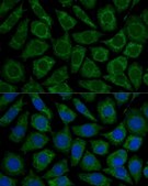 Anti-NDUFS2 antibody produced in rabbit