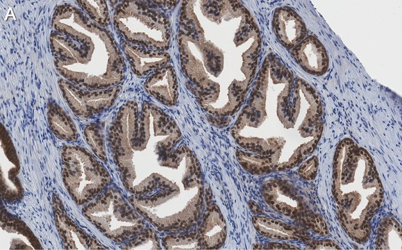 Anti-PRMT5 Antibody, clone 1H16 ZooMAb&#174; Rabbit Monoclonal recombinant, expressed in HEK 293 cells