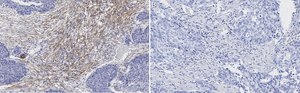 Anti-Zyxin Antibody, clone 2F17 ZooMAb&#174; Rabbit Monoclonal recombinant, expressed in HEK 293 cells