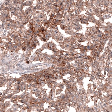 Anti-TNFRSF8 antibody produced in mouse Prestige Antibodies&#174; Powered by Atlas Antibodies, clone CL12632, purified by using Protein A, buffered aqueous glycerol solution