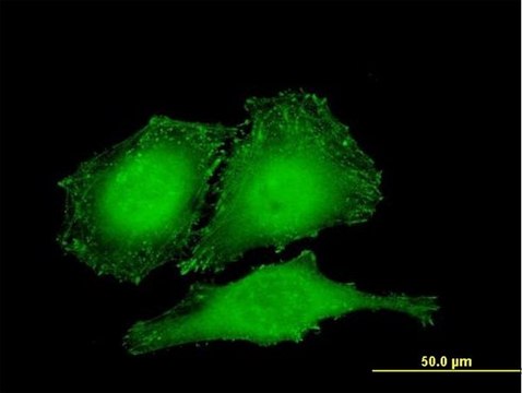 Monoclonal Anti-ZYX antibody produced in mouse clone 2C10-4A7, purified immunoglobulin, buffered aqueous solution