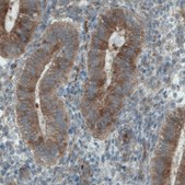 Monoclonal Anti-DIAPH2 antibody produced in mouse Prestige Antibodies&#174; Powered by Atlas Antibodies, clone CL1113, purified immunoglobulin, buffered aqueous glycerol solution