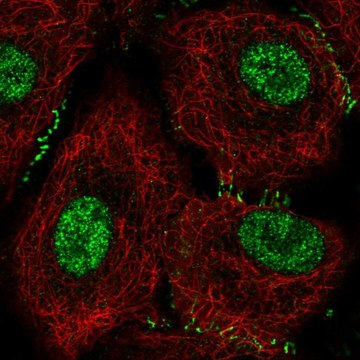 Anti-DPH1 antibody produced in rabbit Prestige Antibodies&#174; Powered by Atlas Antibodies, affinity isolated antibody