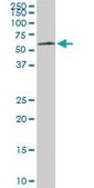 Monoclonal Anti-AAAS antibody produced in mouse clone 5A1, purified immunoglobulin, buffered aqueous solution