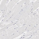 Anti-GPR143 antibody produced in rabbit Prestige Antibodies&#174; Powered by Atlas Antibodies, affinity isolated antibody, buffered aqueous glycerol solution