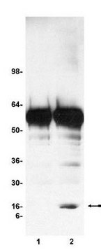 Chromatin Immunoprecipitation (ChIP) Assay Kit Contains all necessary reagents to perform 22 individual chromatin immunoprecipitation (ChIP) reactions using inexpensive protein A agarose beads.