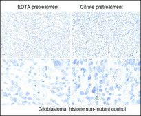 Anti-Histone H3 K27M antibody, Rabbit Monoclonal recombinant, expressed in HEK 293 cells, clone RM192, purified immunoglobulin