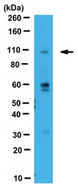 Anti-WWP2 Antibody from rabbit, purified by affinity chromatography