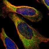Anti-PFKM antibody produced in rabbit Prestige Antibodies&#174; Powered by Atlas Antibodies, affinity isolated antibody, buffered aqueous glycerol solution
