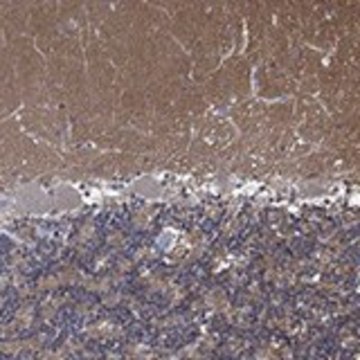 Anti-ZNF671 antibody produced in rabbit Prestige Antibodies&#174; Powered by Atlas Antibodies, affinity isolated antibody, buffered aqueous glycerol solution