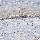 Anti-COL1A1 antibody produced in rabbit Prestige Antibodies&#174; Powered by Atlas Antibodies, affinity isolated antibody, buffered aqueous glycerol solution