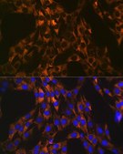 Anti-PUMA antibody produced in rabbit