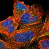 Anti-ABCC1 antibody produced in rabbit Prestige Antibodies&#174; Powered by Atlas Antibodies, affinity isolated antibody, buffered aqueous glycerol solution, Ab1