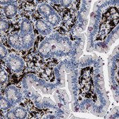Anti-CD226 antibody produced in rabbit Prestige Antibodies&#174; Powered by Atlas Antibodies, affinity isolated antibody, buffered aqueous glycerol solution