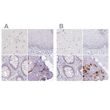 Anti-ACAN antibody produced in rabbit Prestige Antibodies&#174; Powered by Atlas Antibodies, affinity isolated antibody