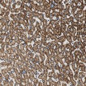 Anti-ALDH4A1 antibody produced in rabbit Prestige Antibodies&#174; Powered by Atlas Antibodies, affinity isolated antibody, buffered aqueous glycerol solution