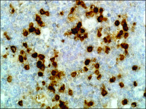 Anti-Human Lambda Light Chain antibody, Rabbit monoclonal recombinant, expressed in HEK 293 cells, clone RM127, purified immunoglobulin