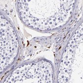 Anti-F13A1 antibody produced in rabbit Prestige Antibodies&#174; Powered by Atlas Antibodies, affinity isolated antibody, buffered aqueous glycerol solution