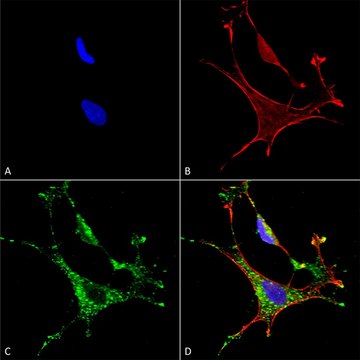 Monoclonal Anti-Copper Transporting Atpase 1 - Hrp antibody produced in mouse clone S60-4, purified immunoglobulin