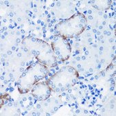 Anti-Phospho-P70 S6K-T389 antibody produced in rabbit