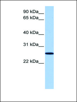 Anti-FBXO36 antibody produced in rabbit affinity isolated antibody