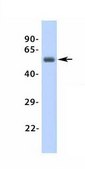 Anti-ADRB1 antibody produced in rabbit affinity isolated antibody