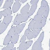 Anti-MYLK antibody produced in rabbit Prestige Antibodies&#174; Powered by Atlas Antibodies, affinity isolated antibody, buffered aqueous glycerol solution