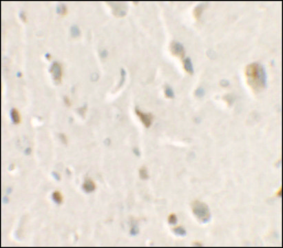 Anti-ULK1 antibody produced in rabbit affinity isolated antibody