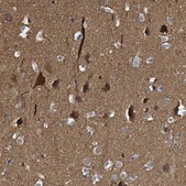 Anti-CRYM antibody produced in rabbit Prestige Antibodies&#174; Powered by Atlas Antibodies, affinity isolated antibody, buffered aqueous glycerol solution