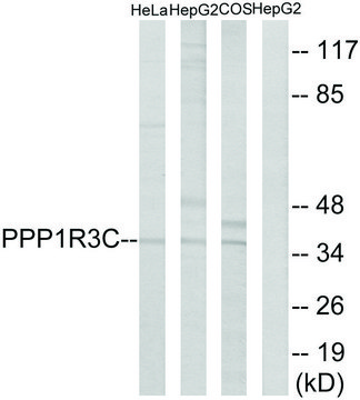 Anti-PPP1R3C antibody produced in rabbit affinity isolated antibody
