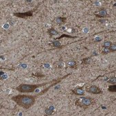 Anti-ARFGAP2 antibody produced in rabbit Prestige Antibodies&#174; Powered by Atlas Antibodies, affinity isolated antibody, buffered aqueous glycerol solution