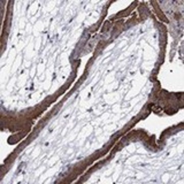Anti-MMAA antibody produced in rabbit Prestige Antibodies&#174; Powered by Atlas Antibodies, affinity isolated antibody, buffered aqueous glycerol solution