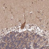 Anti-IGBP1 antibody produced in rabbit Ab1, Prestige Antibodies&#174; Powered by Atlas Antibodies, affinity isolated antibody, buffered aqueous glycerol solution