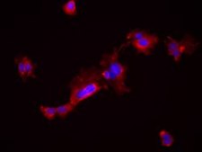MOC22 Mouse Oral Squamous Cell Carcinoma (OSCC) Cell Line