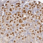 Anti-PIK3R1 antibody produced in rabbit Ab1, Prestige Antibodies&#174; Powered by Atlas Antibodies, affinity isolated antibody, buffered aqueous glycerol solution