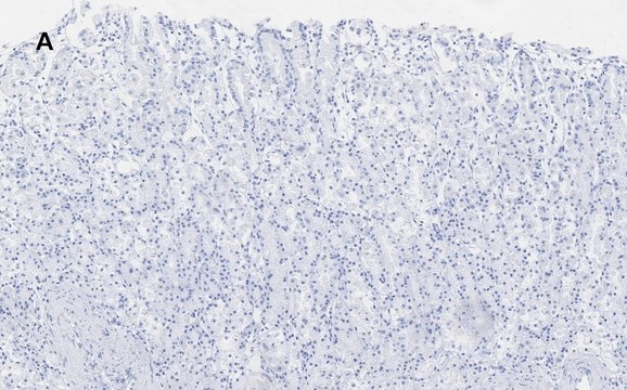 Anti-ALDH1A1 Antibody, clone 4J6, ZooMAb&#174; Rabbit Monoclonal recombinant, expressed in HEK 293 cells