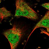 Anti-GBA2 antibody produced in rabbit Prestige Antibodies&#174; Powered by Atlas Antibodies, affinity isolated antibody, buffered aqueous glycerol solution