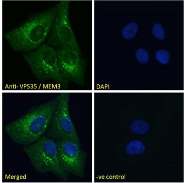 Anti-B5 Receptor/PCID1/EIF3M antibody produced in goat affinity isolated antibody, buffered aqueous solution