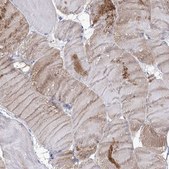 Anti-NRAP antibody produced in rabbit Prestige Antibodies&#174; Powered by Atlas Antibodies, affinity isolated antibody, buffered aqueous glycerol solution