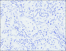Anti-NIPBL antibody produced in goat affinity isolated antibody, buffered aqueous solution