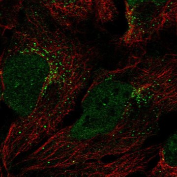 Anti-GGT7 antibody produced in rabbit Prestige Antibodies&#174; Powered by Atlas Antibodies, affinity isolated antibody