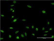 Monoclonal Anti-OLIG2 antibody produced in mouse clone 3C9, purified immunoglobulin, buffered aqueous solution