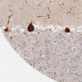 Anti-HARS antibody produced in rabbit Prestige Antibodies&#174; Powered by Atlas Antibodies, affinity isolated antibody, buffered aqueous glycerol solution